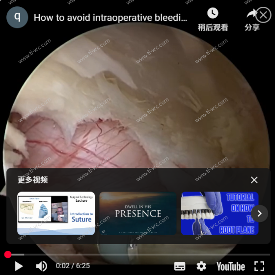 How to avoid intraoperative bleeding during UBE surgery